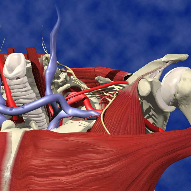 Claviculoplasty Fig 1 (Primal Pics).JPG (853224 bytes)